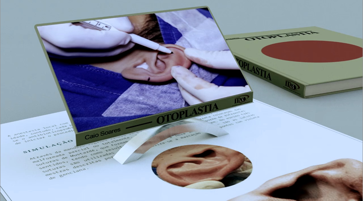 O livro 'Otoplastia', do Instituto Paranaense de Otorrinolaringologia já adotou a tecnologia de realidade aumentada, apresentando aos médicos a possibilidade de acompanhar vídeos de cirurgias e demonstrações de técnicas cirúrgicas | Reprodução